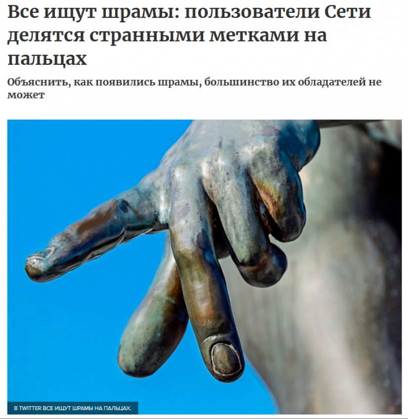 La gente de repente se dio cuenta de que todos ellos tienen una cicatriz en el dedo índice