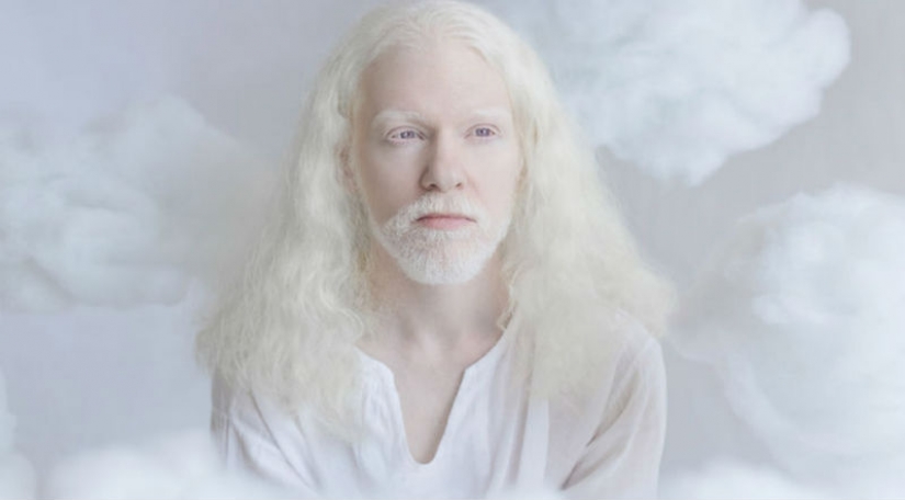 La hipnótica belleza de los albinos en el proyecto de Julia Taits