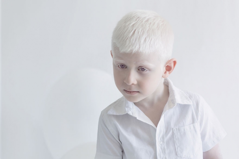 La hipnótica belleza de los albinos en el proyecto de Julia Taits
