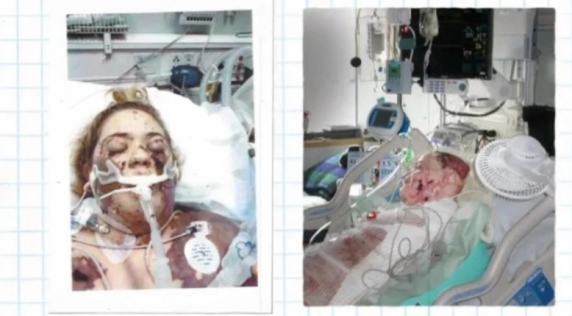 La infinita voluntad de vivir: blogger sin brazos y piernas crea un impresionante cambio de imagen