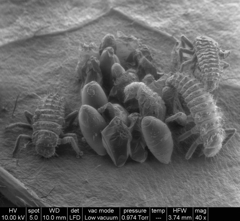 Las fotos tomadas con un microscopio electrónico Las fotos tomadas con un microscopio electrónico