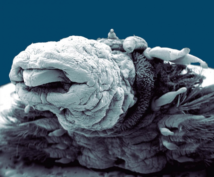 Las fotos tomadas con un microscopio electrónico Las fotos tomadas con un microscopio electrónico