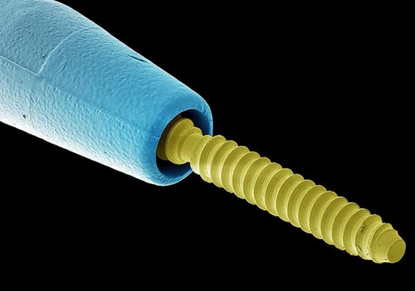 Lo que acecha en su boca, muy de cerca