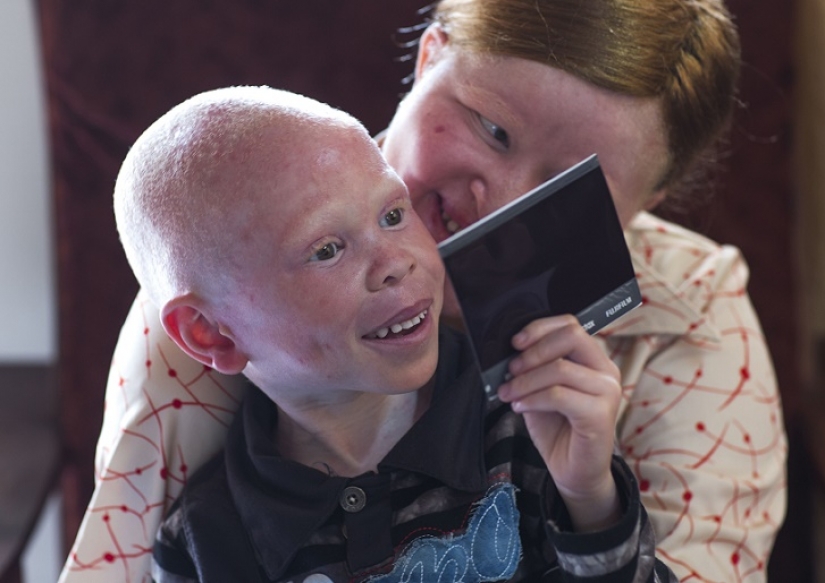 Los albinos de tanzania, cuyos cuerpos valen más que el oro Los albinos de tanzania, cuyos cuerpos valen más que el oro