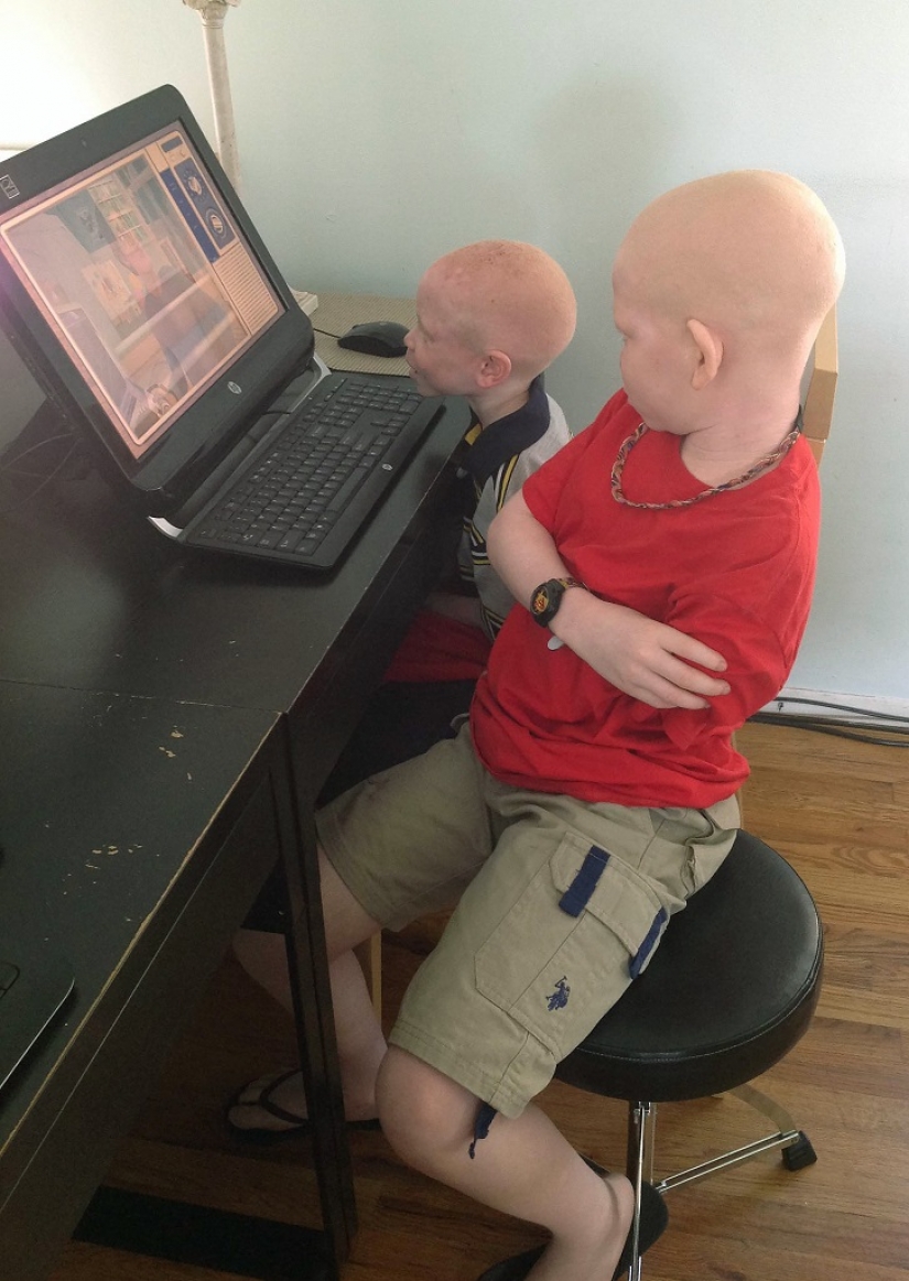 Los albinos de tanzania, cuyos cuerpos valen más que el oro Los albinos de tanzania, cuyos cuerpos valen más que el oro