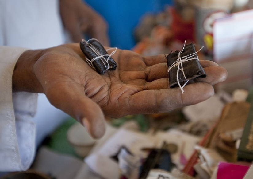 Los albinos de tanzania, cuyos cuerpos valen más que el oro Los albinos de tanzania, cuyos cuerpos valen más que el oro