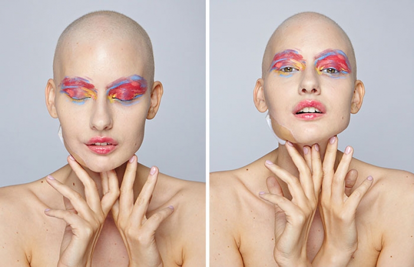 Los doctores le dijeron que el modelo tiene un aborto después de que se ha eliminado el 95% de la mandíbula para el cáncer — y eso es lo que ella hizo