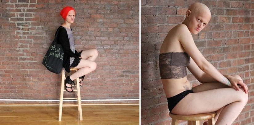 Los modelos que nos inspiran no sólo por su belleza sino también increíble fortaleza