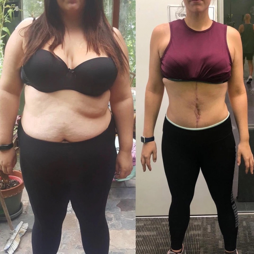 Lost, not to be a flop in bed: the girl dropped 64 kg for bright intimate life