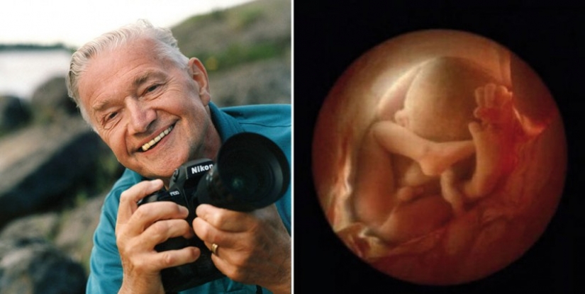 Material único de la concepción hasta el nacimiento