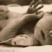 "Mi madre tuvo un aborto en el 8º mes, pero he sobrevivido," Melissa ODEN fue capaz de perdonar y escribió un libro