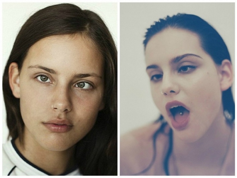 Models that inspire us not only for its beauty but also incredible fortitude Models that inspire us not only for its beauty but also incredible fortitude