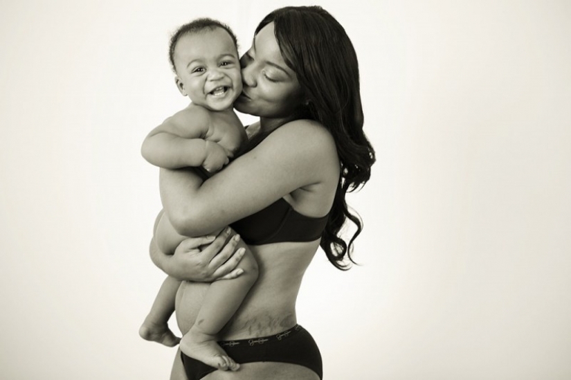 Motherhood more stretch marks and scars: the photocycle of how women fall in love with your body after childbirth