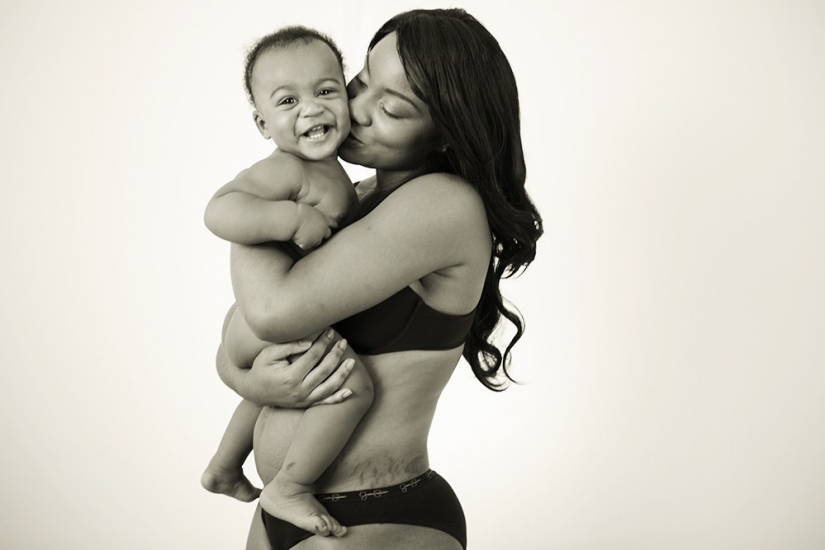 Motherhood more stretch marks and scars: the photocycle of how women fall in love with your body after childbirth