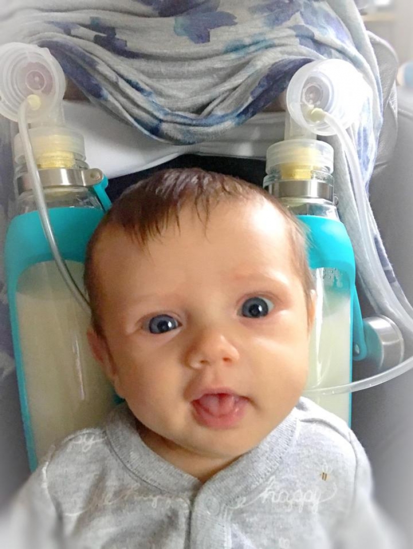 Mujer con síndrome de giperestezii donado 2.5 toneladas de leche materna