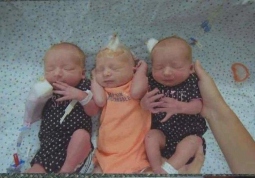 No aleatoria accidente: una mujer dio a luz a trillizos, no saber sobre el embarazo