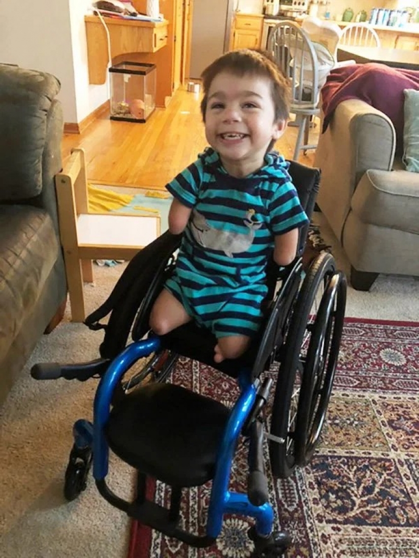 No arms, no legs, no problem: meet the 4-year-old Henry