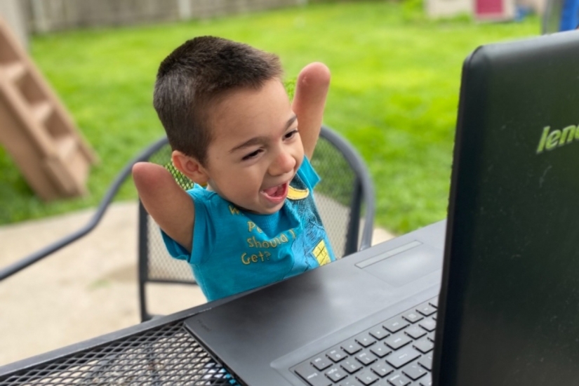 No arms, no legs, no problem: meet the 4-year-old Henry