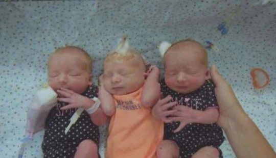 Non-random accident: a woman gave birth to triplets, not knowing about the pregnancy