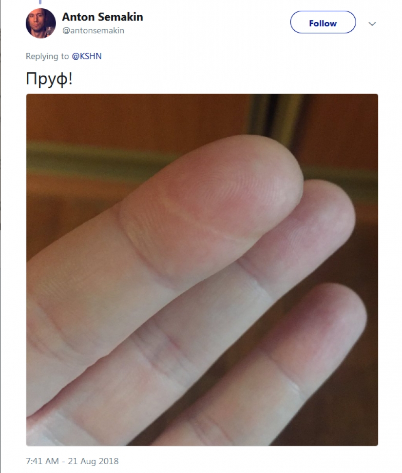 People suddenly realized that all of them have a scar on the index finger People suddenly realized that all of them have a scar on the index finger