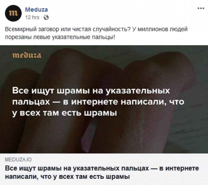 People suddenly realized that all of them have a scar on the index finger People suddenly realized that all of them have a scar on the index finger