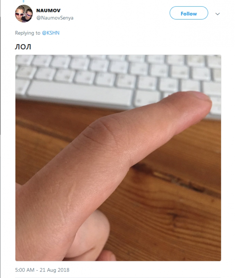 People suddenly realized that all of them have a scar on the index finger People suddenly realized that all of them have a scar on the index finger