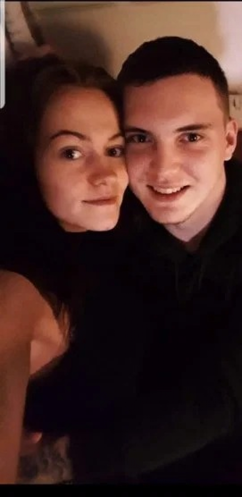 Rare syndrome: when the wife was pregnant, her husband was suffering from morning sickness and overeating