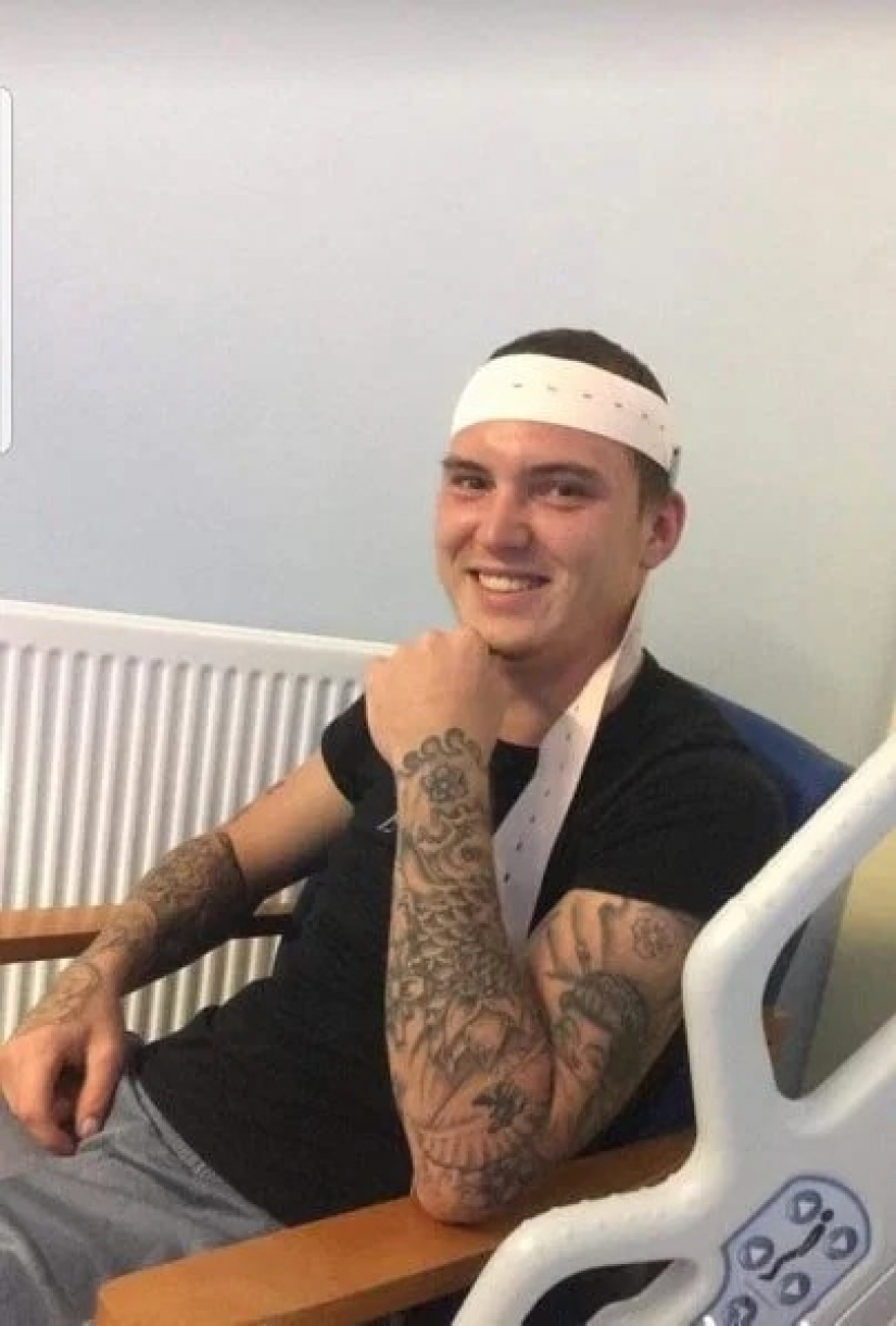 Rare syndrome: when the wife was pregnant, her husband was suffering from morning sickness and overeating