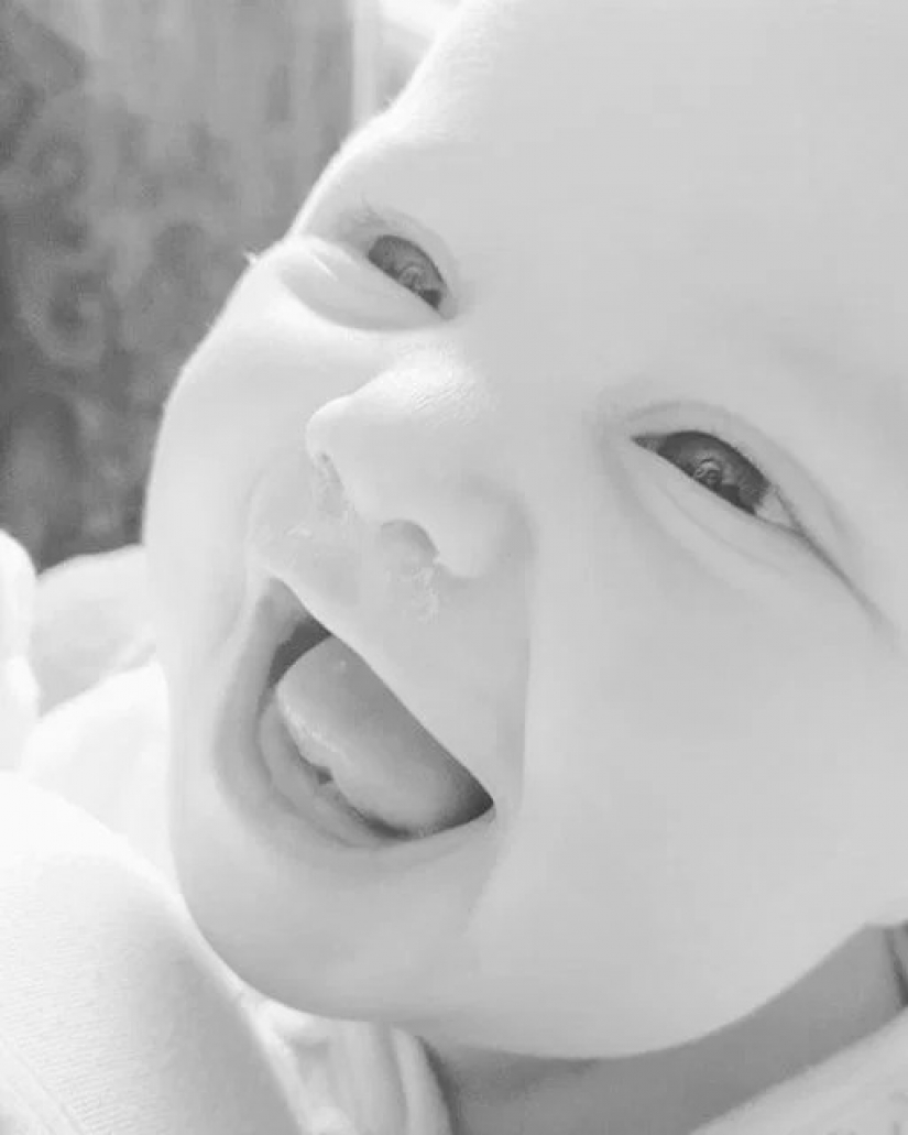 Rare syndrome: when the wife was pregnant, her husband was suffering from morning sickness and overeating