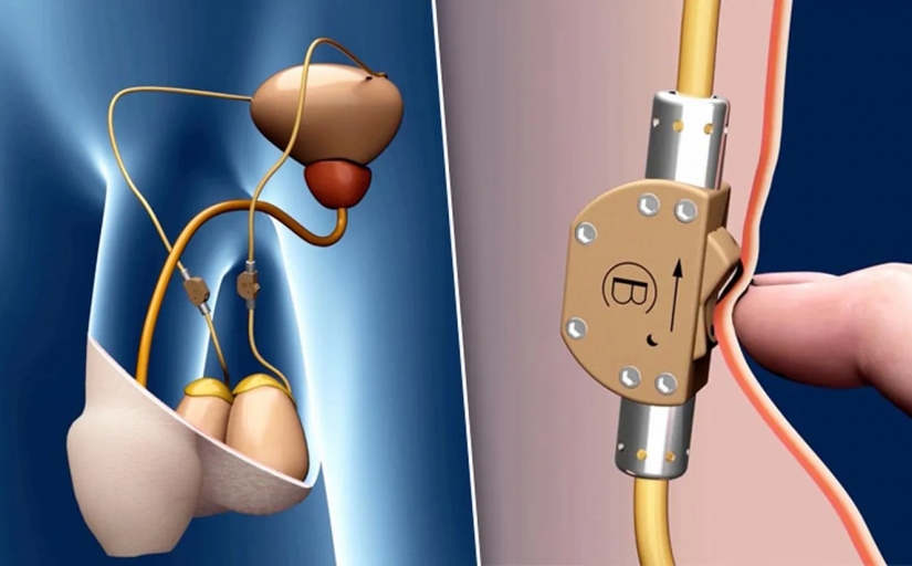 Sex breakthrough: the 5 most incredible scientific achievements of the recent years