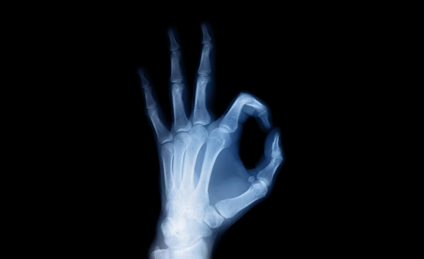 Ten scientific discoveries that happened by accident Ten scientific discoveries that happened by accident