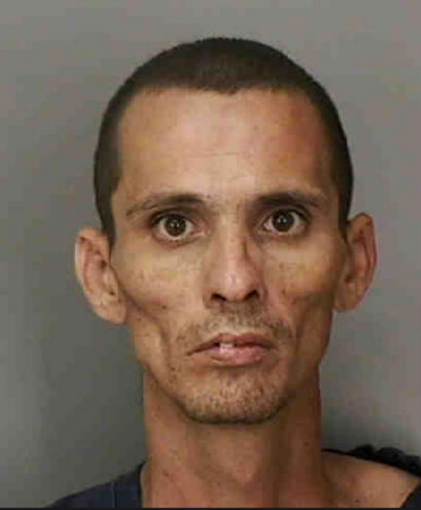 Terrible consequences of the use of methamphetamines