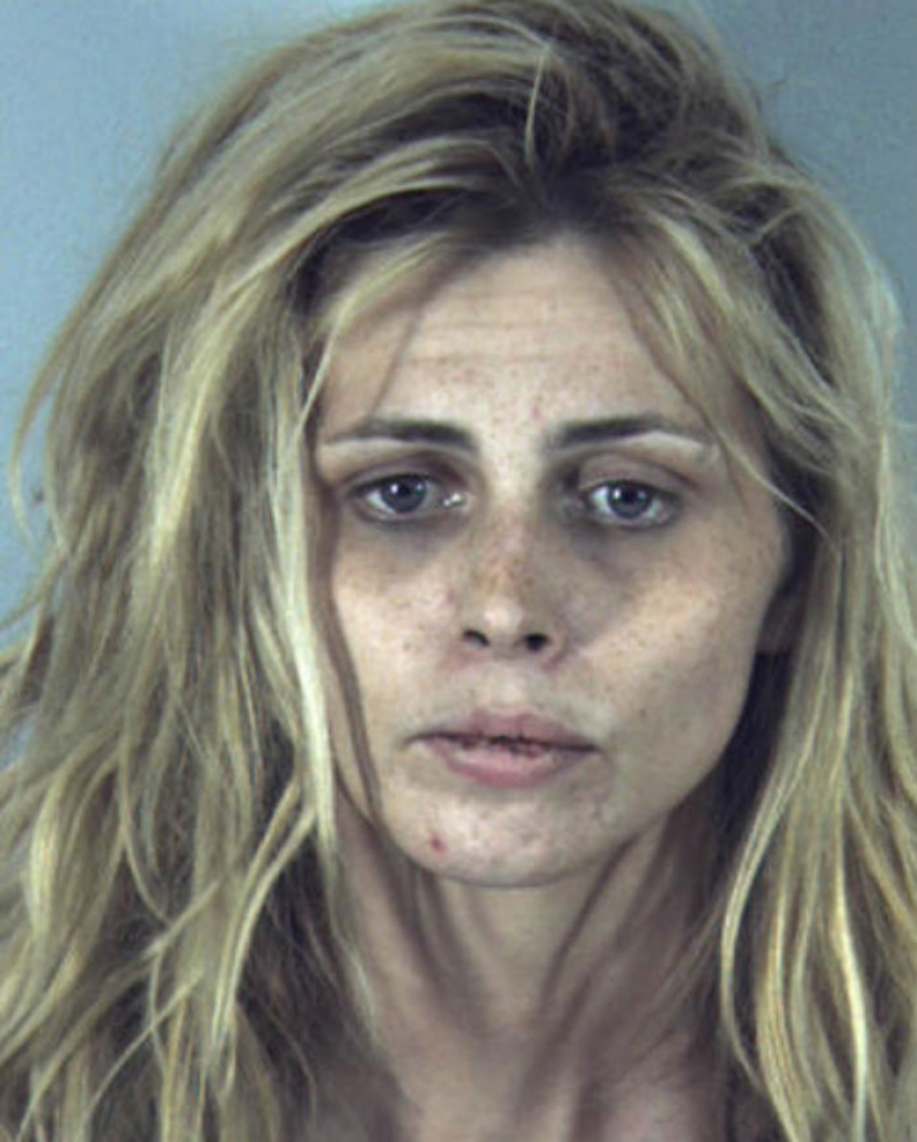 Terrible consequences of the use of methamphetamines