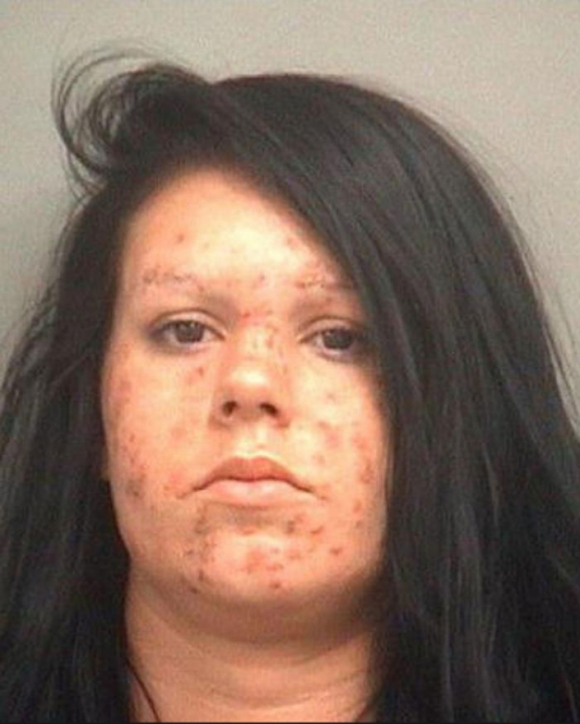 Terrible consequences of the use of methamphetamines