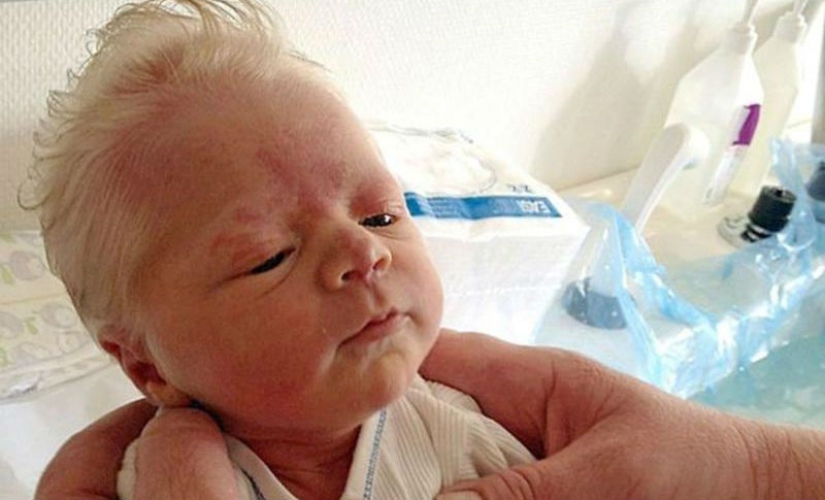 The babies look like little old men