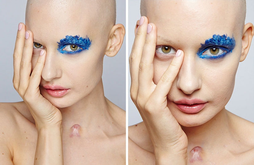 The doctors told the model to have an abortion after she has deleted 95% of the jaw to cancer — and that's what she did The doctors told the model to have an abortion after she has deleted 95% of the jaw to cancer — and that's what she did