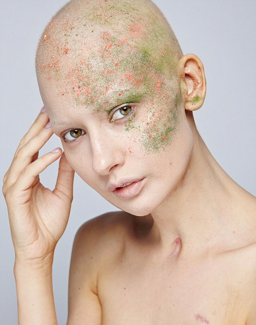 The doctors told the model to have an abortion after she has deleted 95% of the jaw to cancer — and that's what she did The doctors told the model to have an abortion after she has deleted 95% of the jaw to cancer — and that's what she did