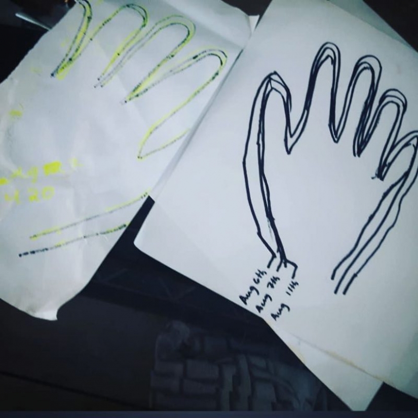 The girl gradually became ugly and the doctors for years could not find the cause. Fortunately, all ended well The girl gradually became ugly and the doctors for years could not find the cause. Fortunately, all ended well