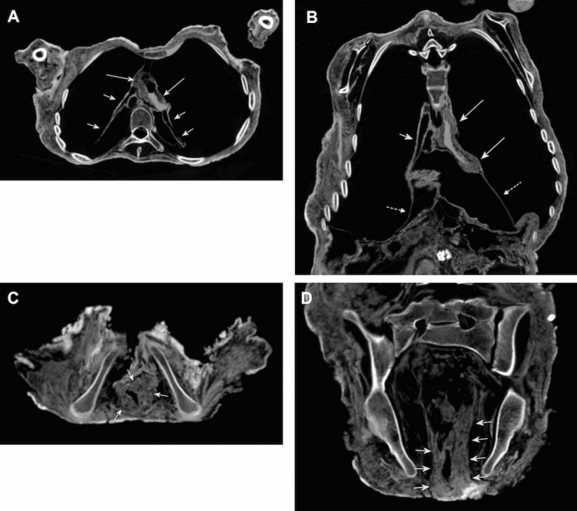 The Inca mummies of sacrificed children and women