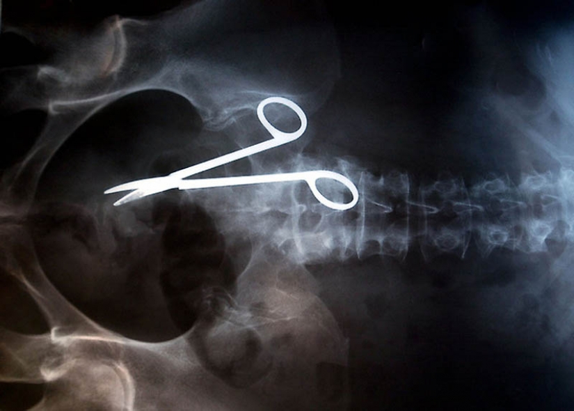 The most bizarre x-rays