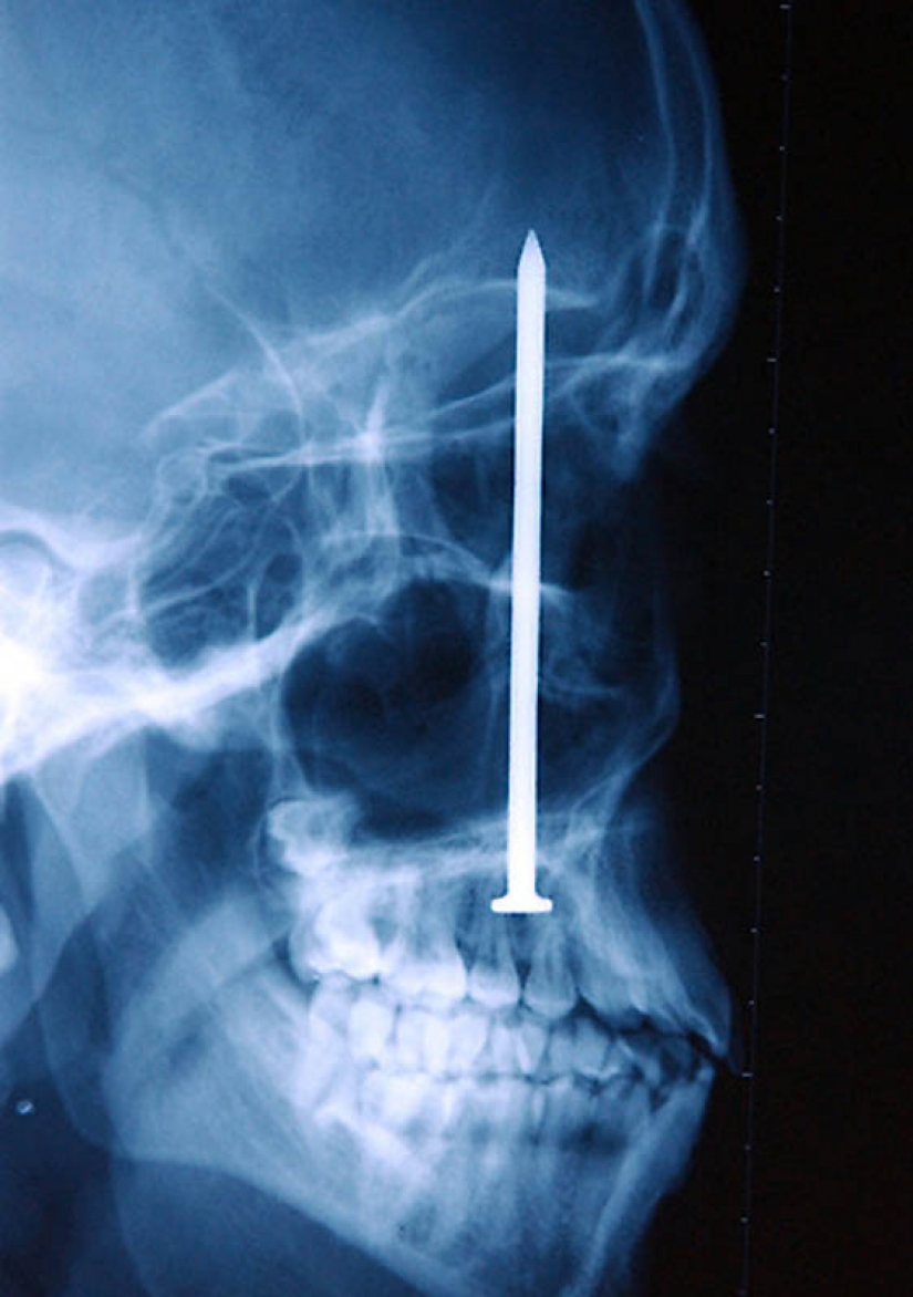 The most bizarre x-rays