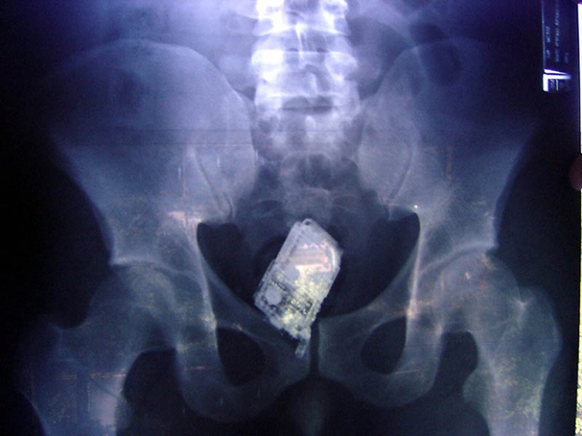 The most bizarre x-rays