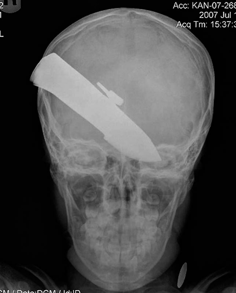 The most bizarre x-rays