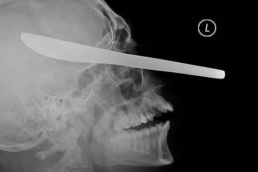 The most bizarre x-rays