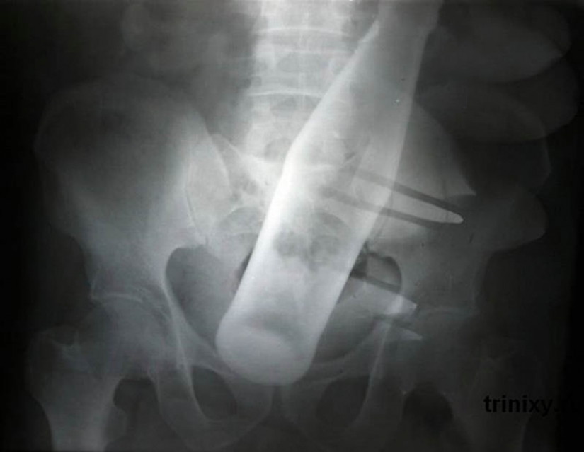 The most bizarre x-rays