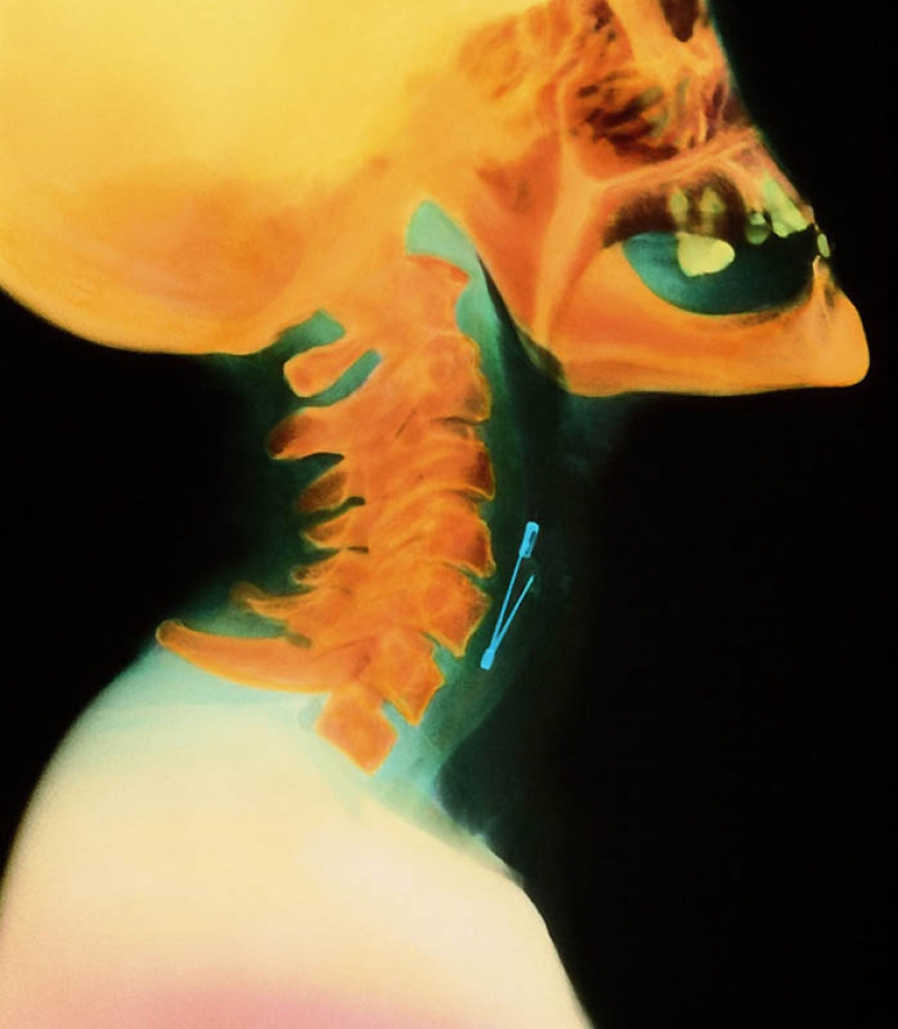 The most bizarre x-rays