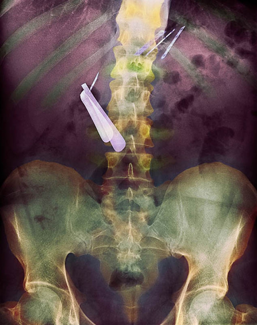 The most bizarre x-rays