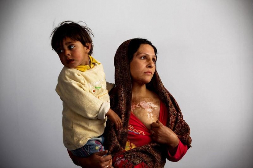 The unequal marriage in the Asian