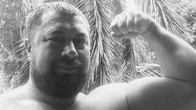 The wife asked her husband to stop snoring, he went to Moscow and died there after rhinoplasty at a discount