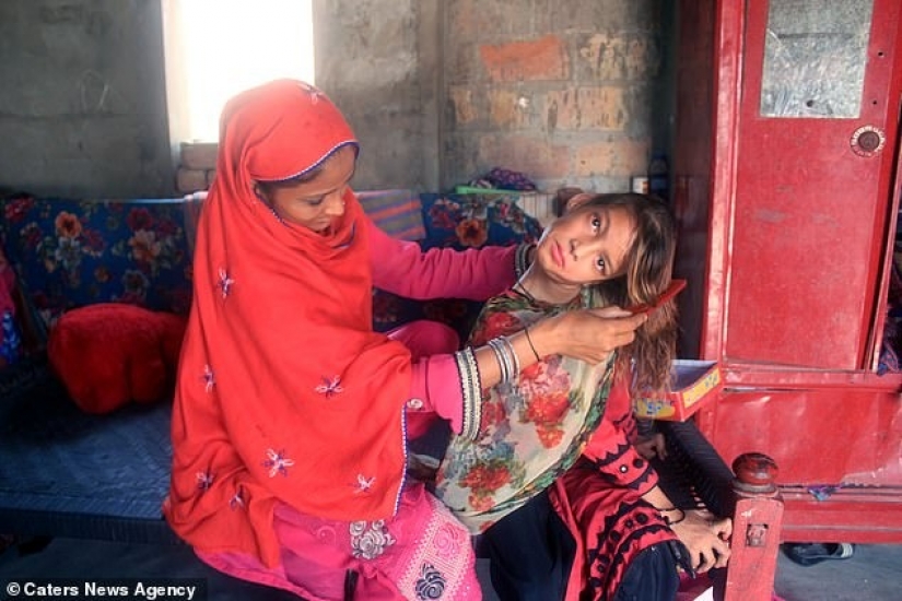 The world is at a right angle: neck 11-year-old Pakistani turned 90 degrees The world is at a right angle: neck 11-year-old Pakistani turned 90 degrees